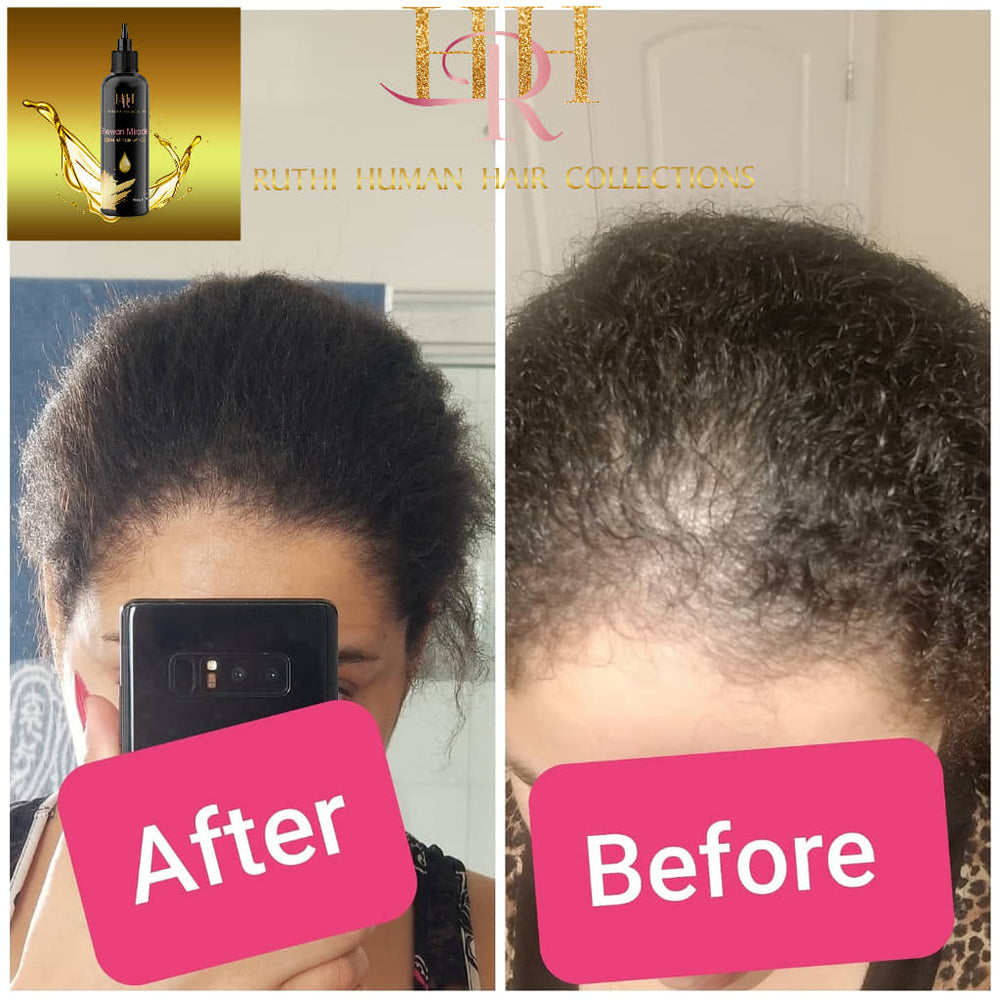 Hair Growth Herbal Oil